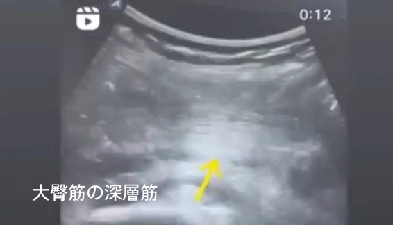 �Ƕ���٥��EMS�ǿ����ޤǿ�ư����ã��